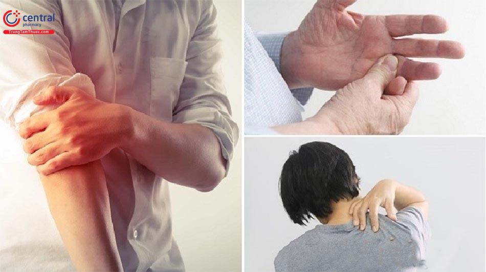 Hội chứng cổ - vai - cánh tay là gì?