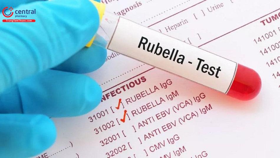 Bệnh Rubella: Nguyên nhân, chẩn đoán, biến chứng và điều trị